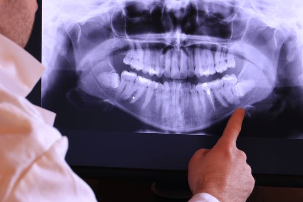 Best Cracked Tooth Emergency Dentist  in Sylvan Springs, AL
